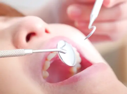 セカンドオピニオン