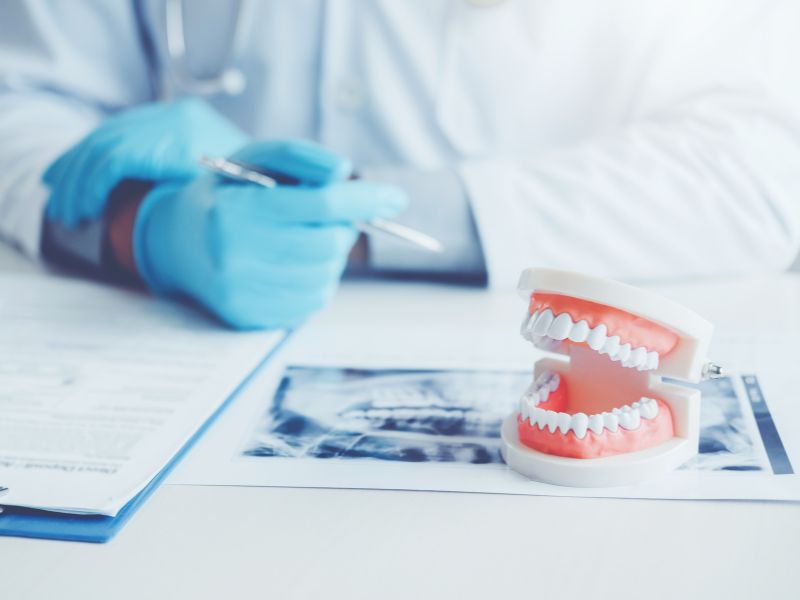 親知らず抜歯の流れ