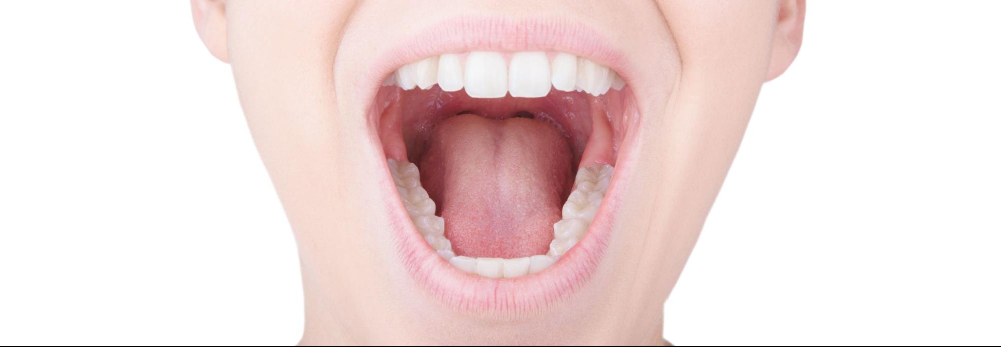 口腔がんが発症しやすい部位