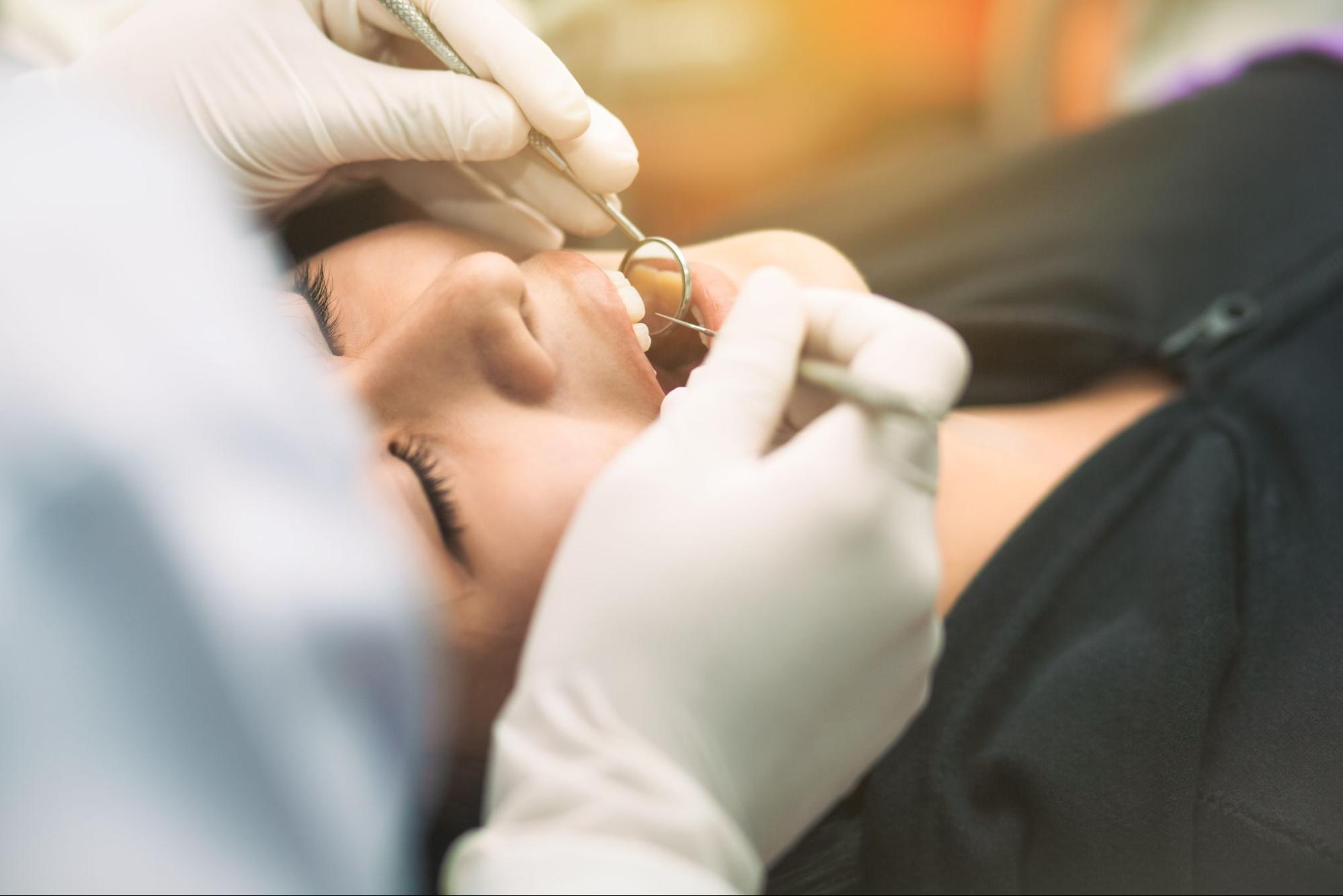 歯周病治療の流れ