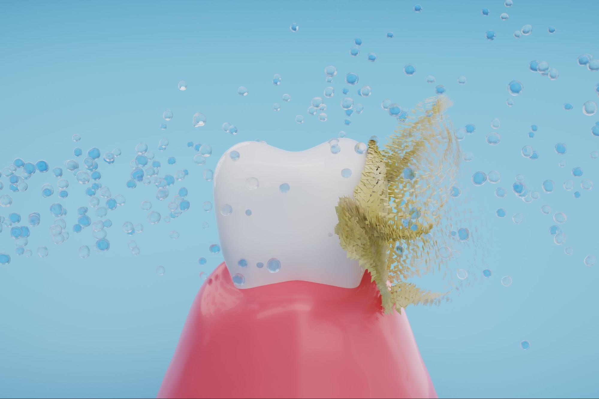 予防歯科の重要性